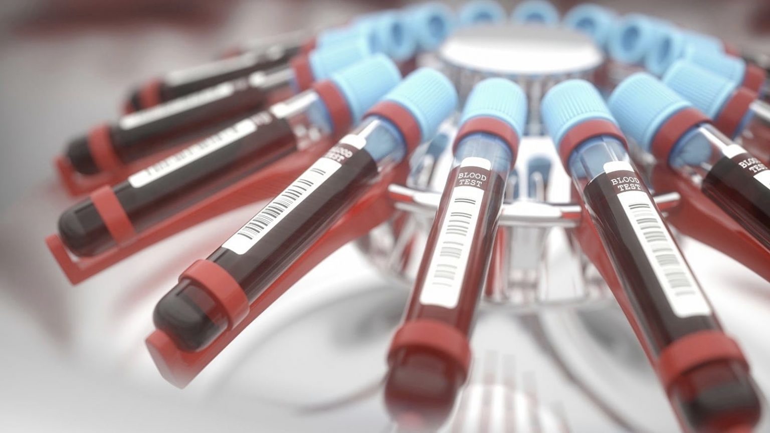 Ezekkel fontos tiszt&aacute;ban lenni v&eacute;rv&eacute;tel előtt, k&ouml;zben &eacute;s ut&aacute;n!